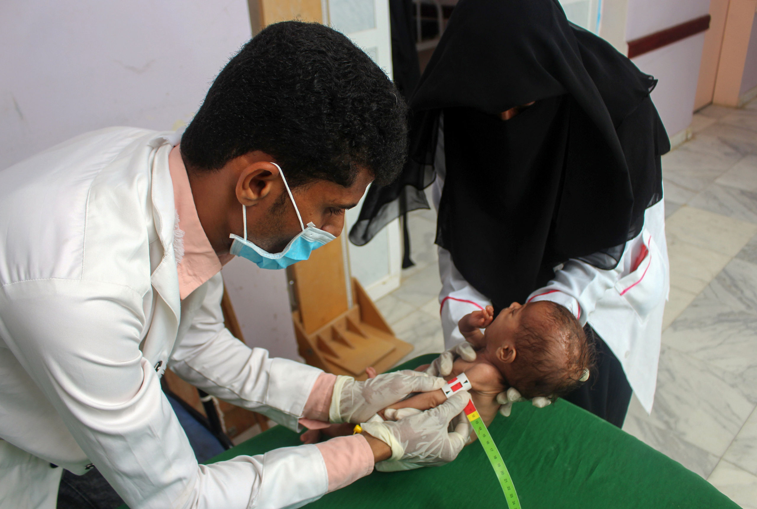 Een ondervoed kind uit Jemen wordt onderzocht door medisch personeel.