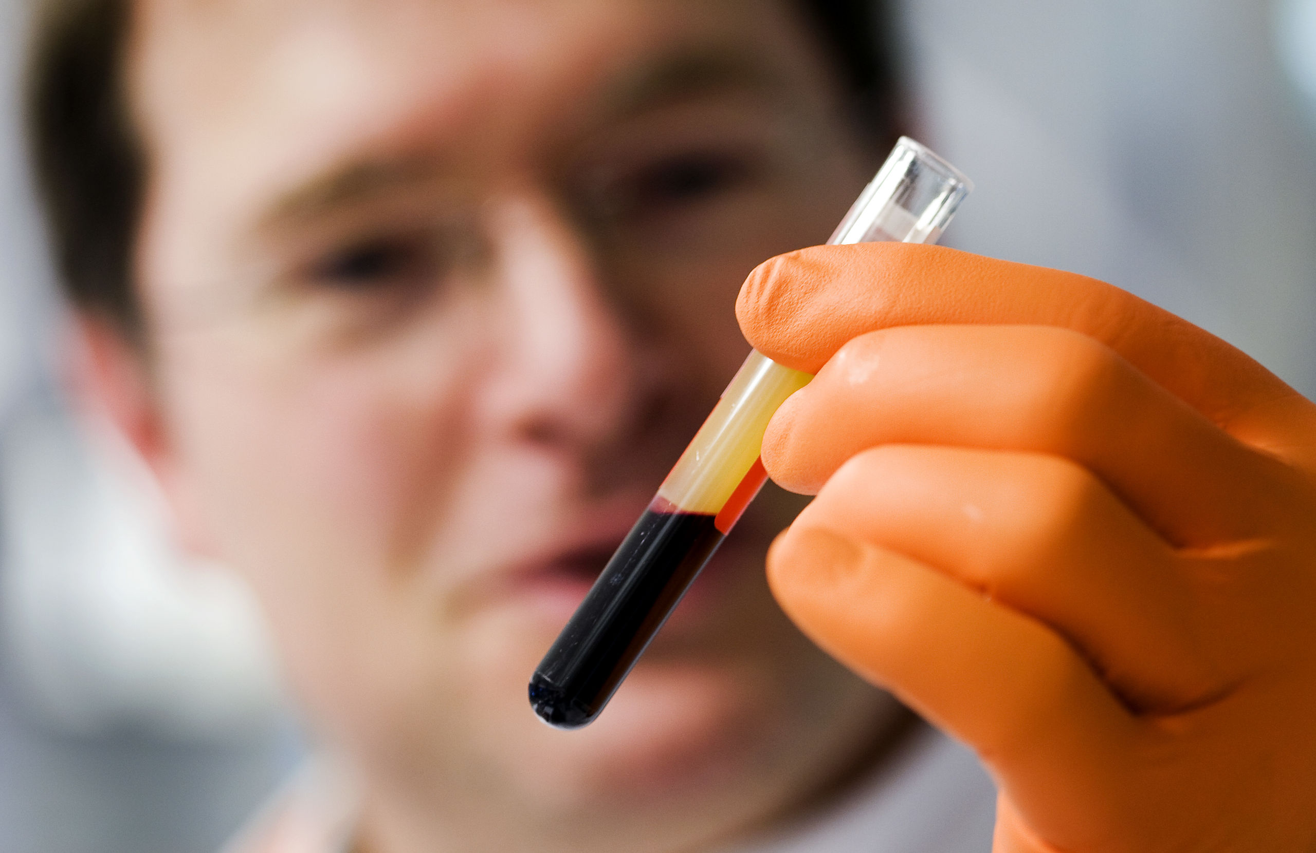 Een medewerker van bloedtransfusiedienst Sanquin in Amsterdam houdt in het laboratorium een buisje met bloed vast. In het lab vindt de controle van het bloed plaats. 