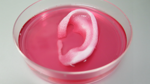 Een oor uit de printer (Foto: Wake Forest Institute for Regenerative Medicine)