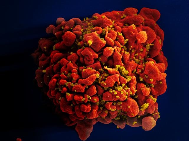 Illustratie: HIV-geïnfecteerde cel. Bron: NIAID Flickr