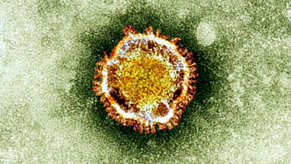 Het Coronavirus, dat in 2013 kortstondig toesloeg.