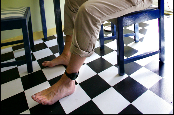 De voeten van Joost Eerdmans, die in 2005 de werking van de enkelband uittestte