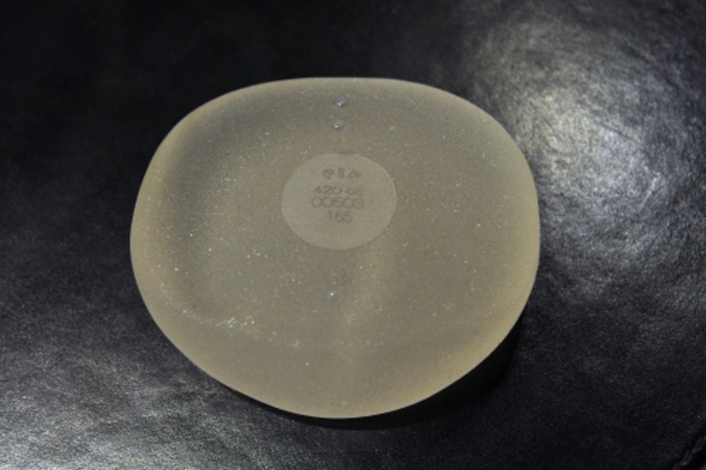 EPA