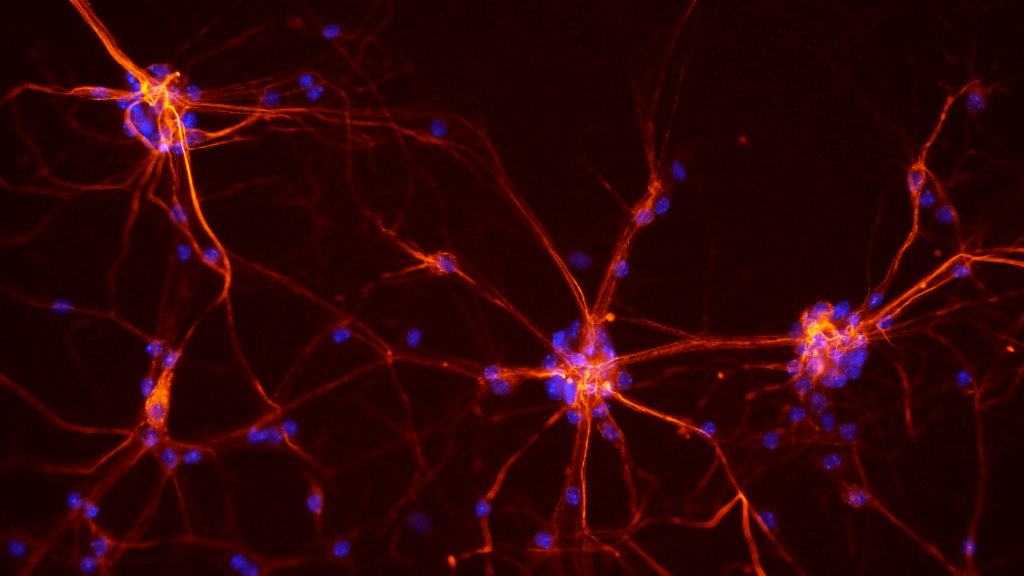 Neuronen uit het ruggenmerg van een muis (Afbeelding: NICHD/S. Jeong)
