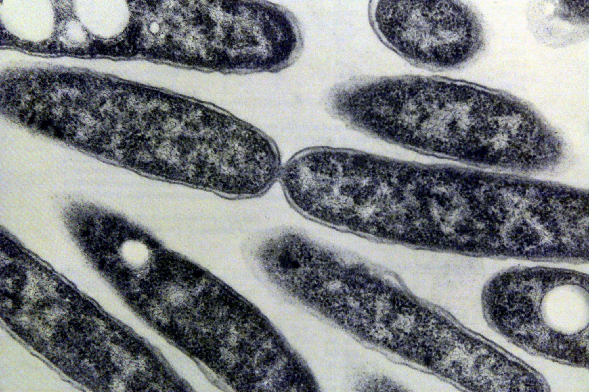 1999-03-16 14:24:36 De Legionella Pneuophila bacterie ongeveer negenduizend keer uitvergroot met een electronen microscoop. De bacterie is de veroorzaker van de veteranenziekte.