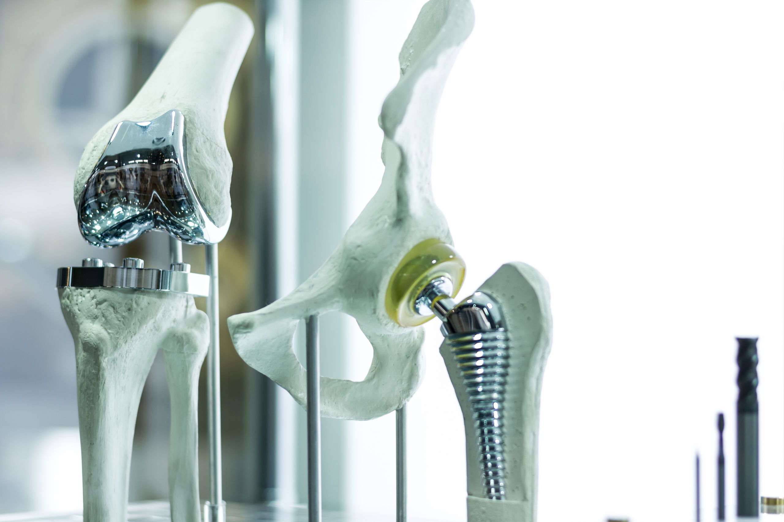 Een 3D geprinte knie en een heupprothese.