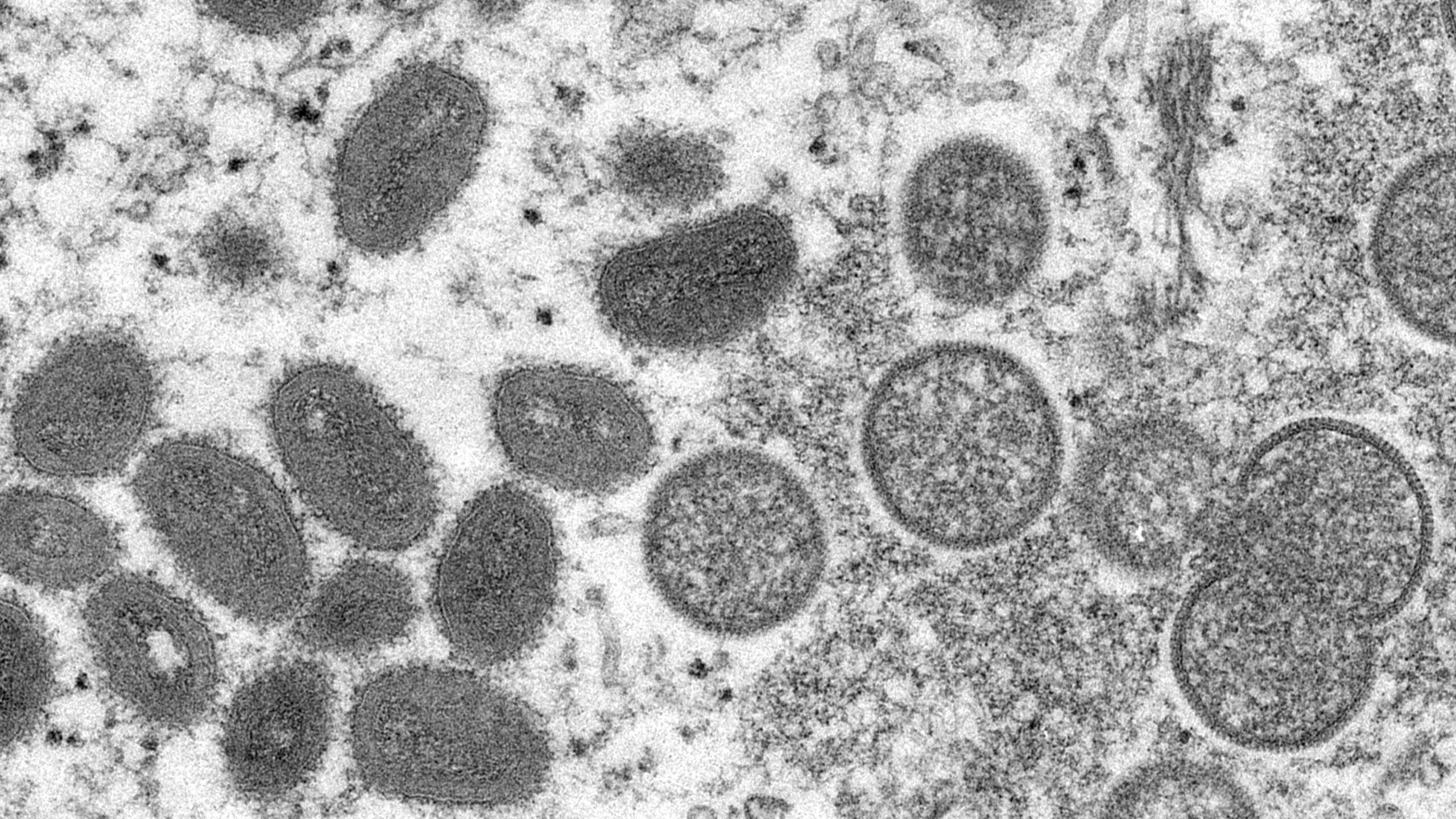 Het apenpokkenvirus onder de microscoop.