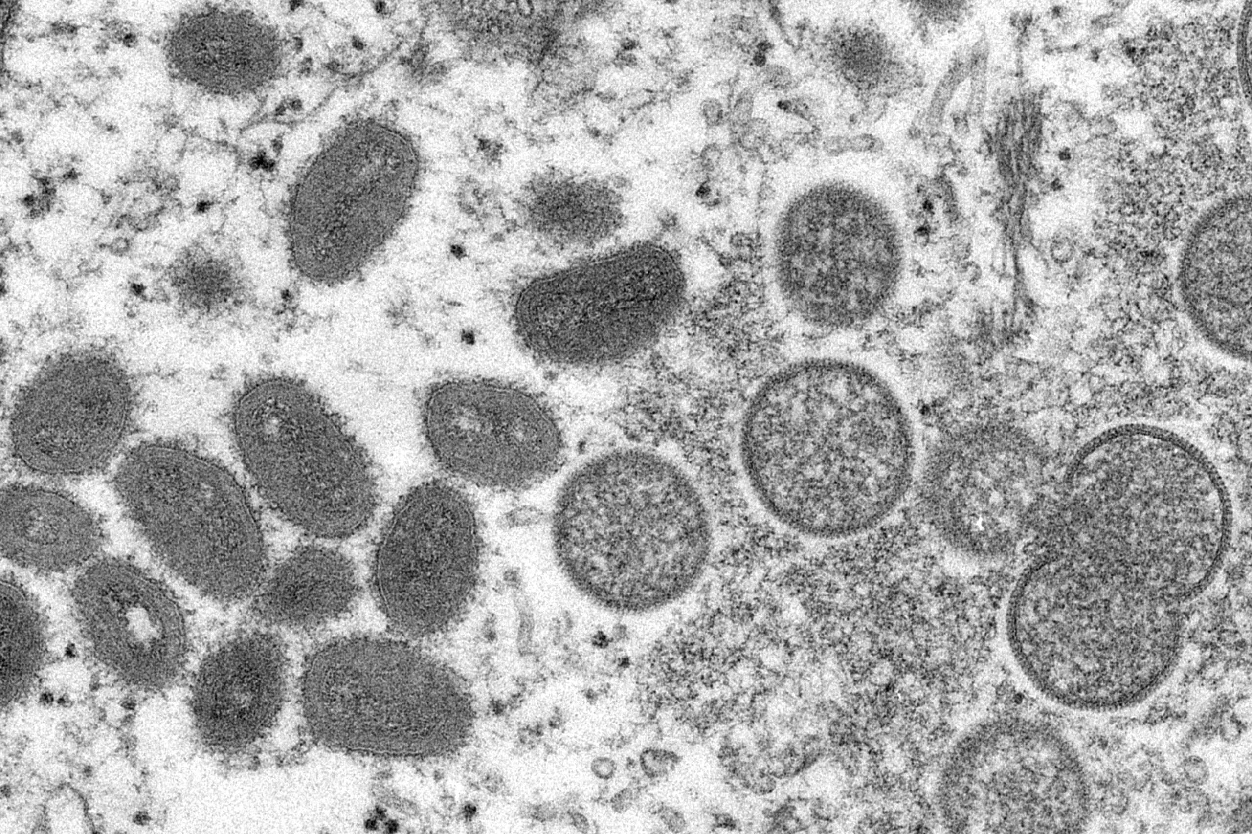 Het apenpokkenvirus onder de microscoop.